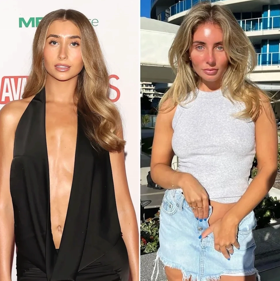 Lily Phillips và những câu hỏi về sức khỏe tâm thần